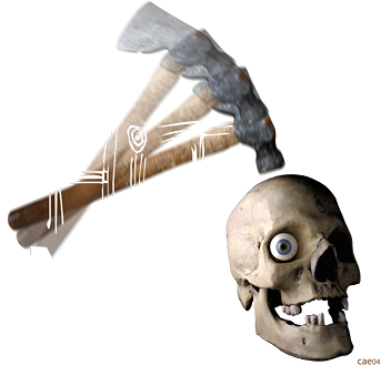 I Hit My Head by Corey A. Edwards